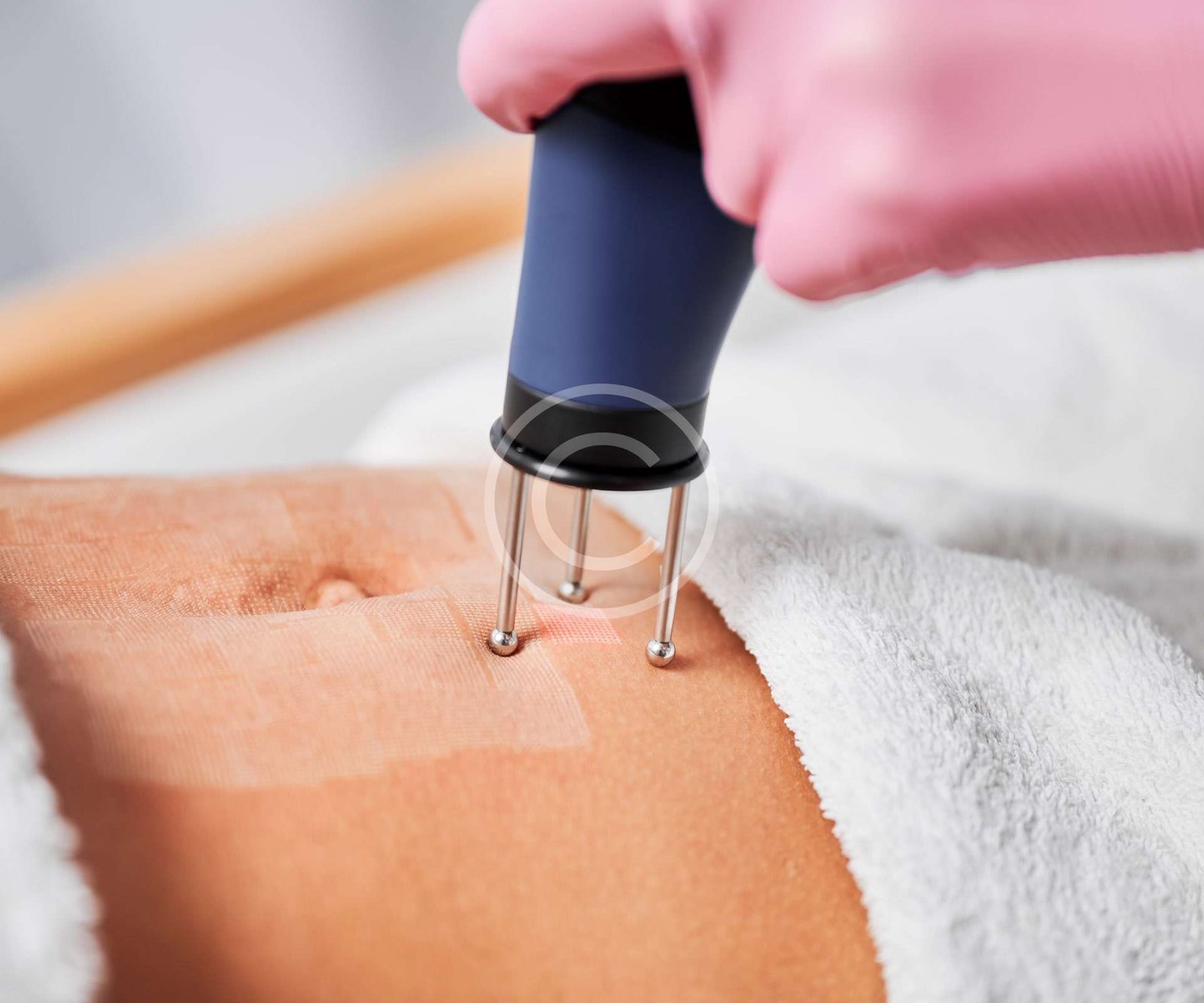 Skin renewal